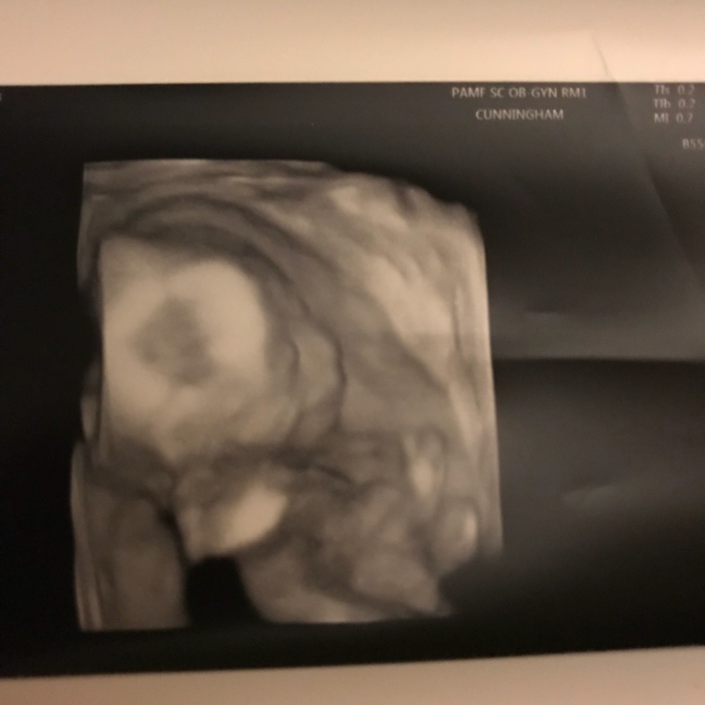 Meet your Posher, Blanca